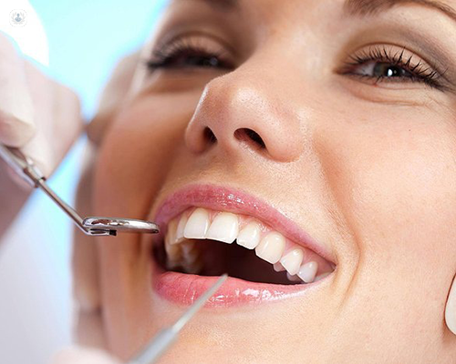 Dental Implants in Tampa: A Comprehensive Guide