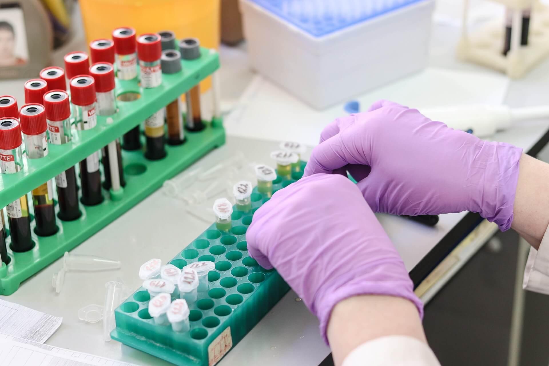 Understanding Parallel Artificial Membrane Permeability Assay (PAMPA): A Gateway to Assessing Drug Permeability