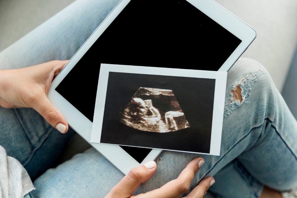 The Future of Expecting Exploring 3D Scans for Pregnancy