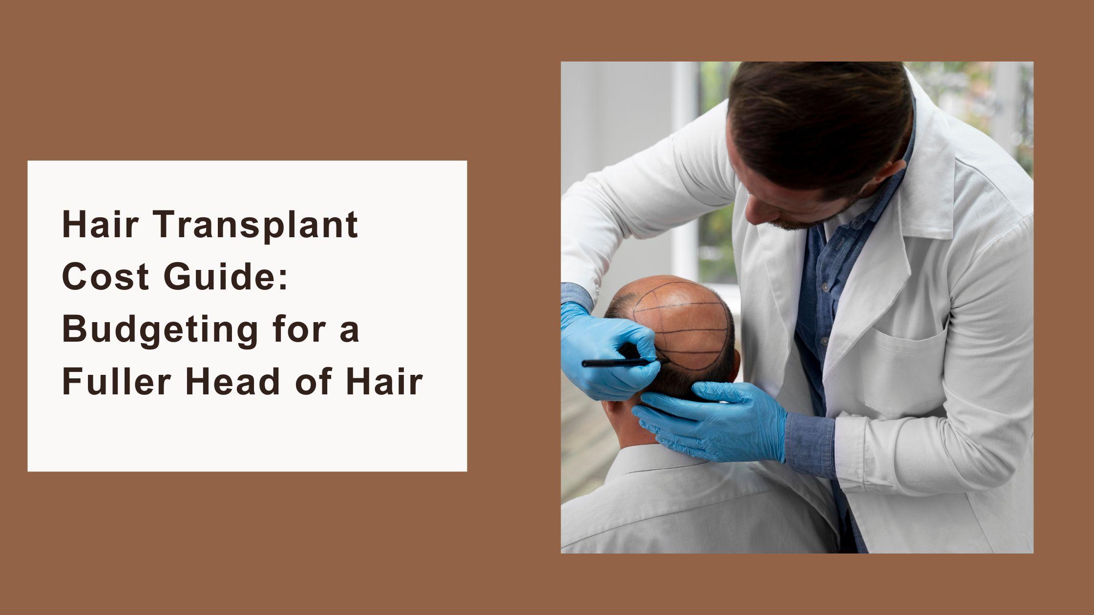 Hair Transplant Cost Guide: Budgeting for a Fuller Head of Hair