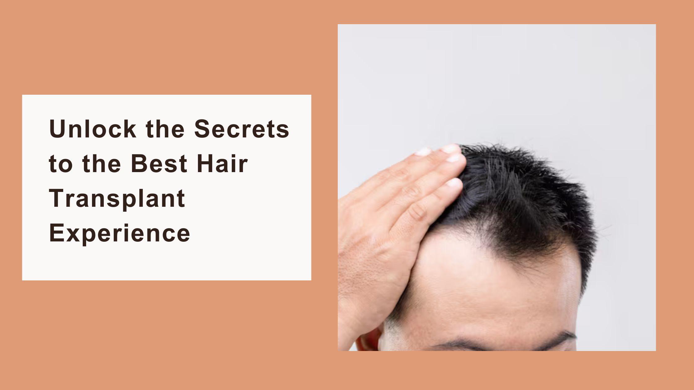 Unlock the Secrets to the Best Hair Transplant Experience