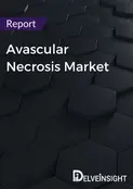 Exploring the Evolving Avascular Necrosis Treatment Landscape
