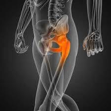 A Complete Guide to Hip Replacement Recovery in Jaipur