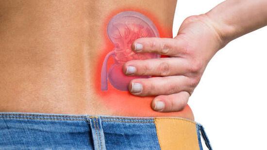 Recognizing the Warning Signs: How to Detect Kidney Stones Early