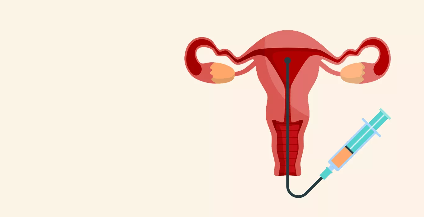 Affordable IVF Clinics in Bangalore: Budget-Friendly Options for You