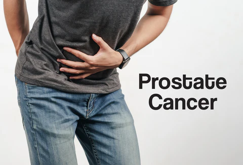 Prostate Cancer Symptoms: What Every Man Should Know