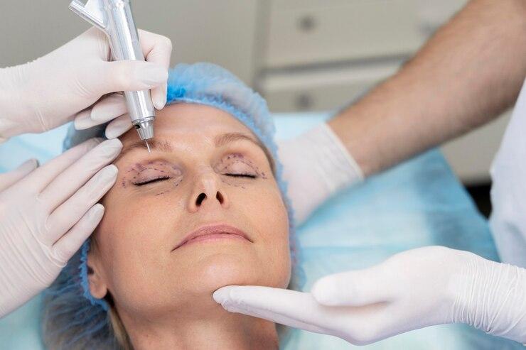 How to Choose a Qualified Surgeon for Lower Blepharoplasty