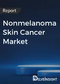 DelveInsight’s Analysis of the Nonmelanoma Skin Cancer Market and Pipeline Evolution