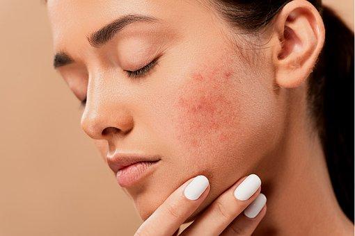 Can Microneedling Be Performed on Sensitive Areas, Like Around the Eyes or Neck?