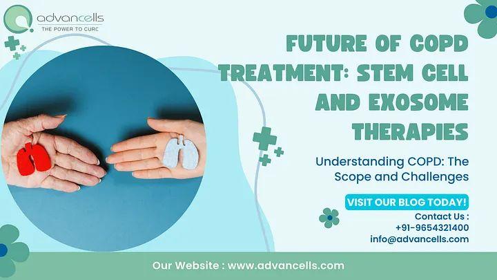 Future of COPD Treatment: Stem Cell and Exosome Therapies