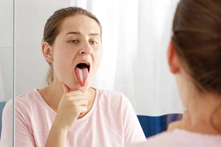 Top Natural Remedies for Burning Mouth Syndrome That Really Work