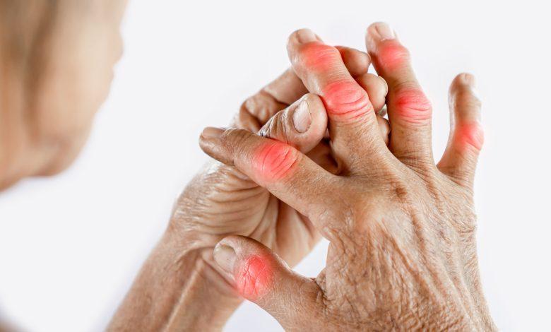 Arthritis Symptoms, Causes, Diagnosis and Treatment
