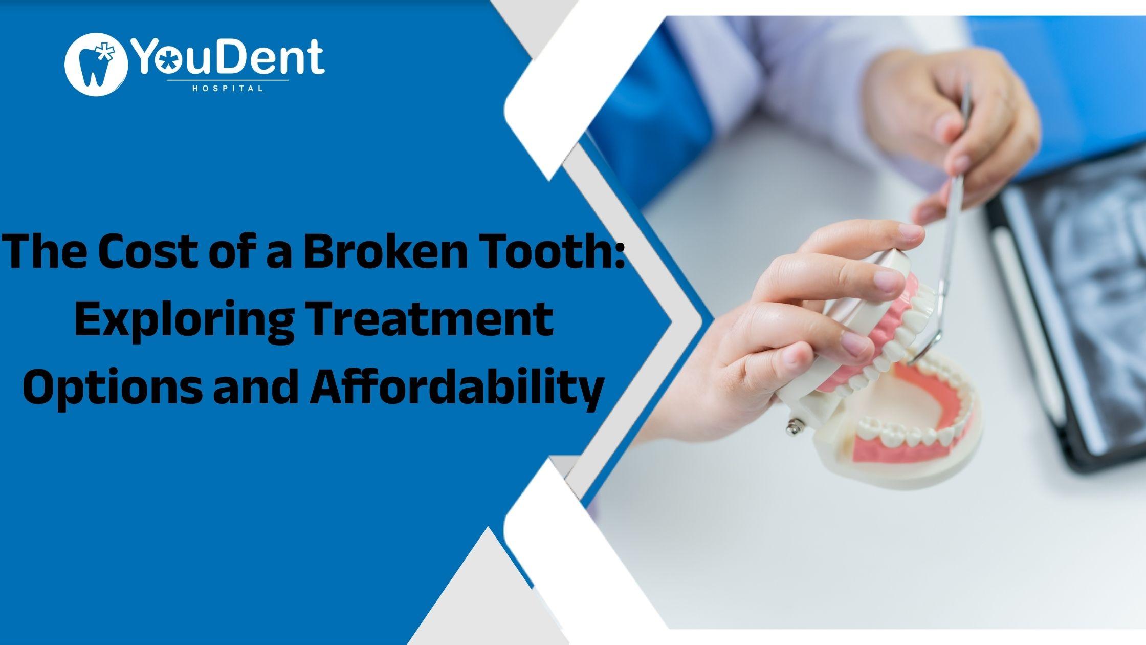 The Cost of a Broken Tooth: Exploring Treatment Options and Affordability
